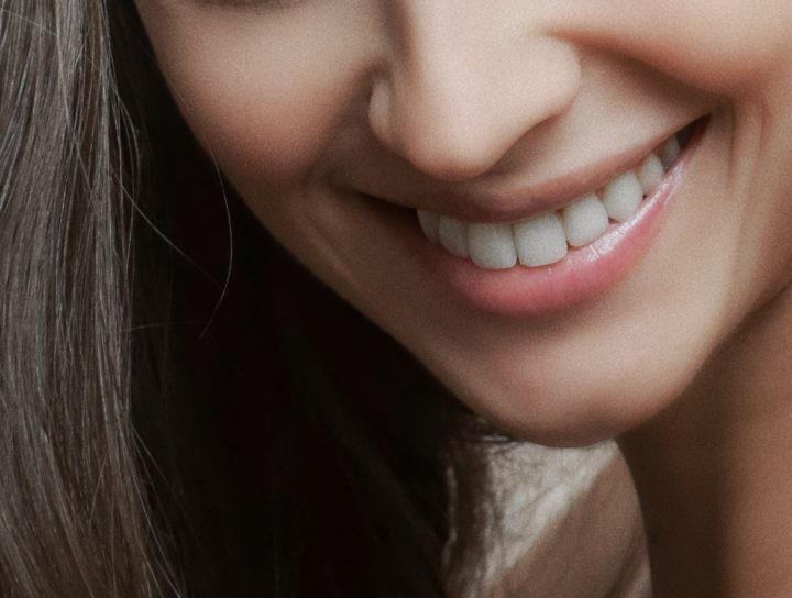 What Are Porcelain Veneers and How Do They Work?