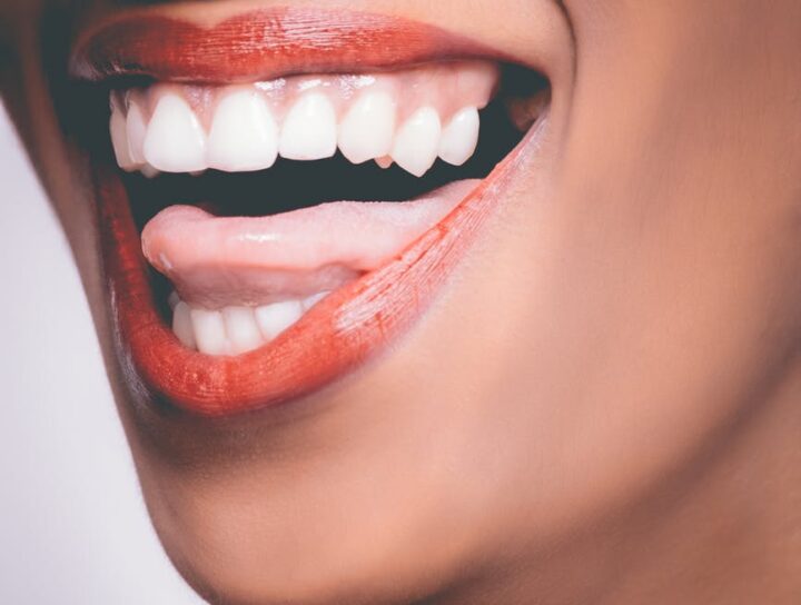 Slough Based Dentist